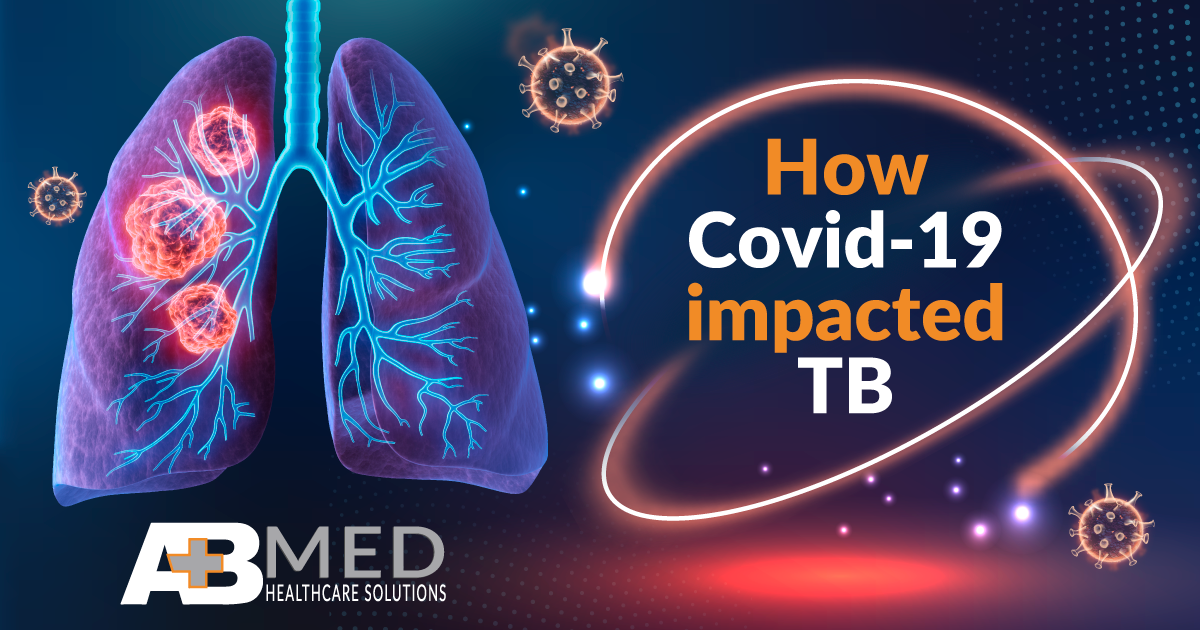 THE EFFECT OF COVID-19 ON TUBERCULOSIS TREATMENT AND PREVENTION